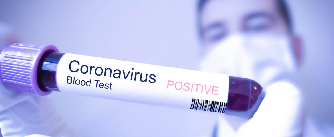 România se află în scenariul 3. Numărul cazurilor confirmate de coronavirus depășește deja 100