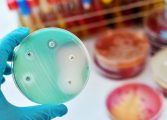 Care sunt bacteriile cu cea mai mare rezistență la antibiotic și ce infecții pot provoca. Lista surselor de contaminare