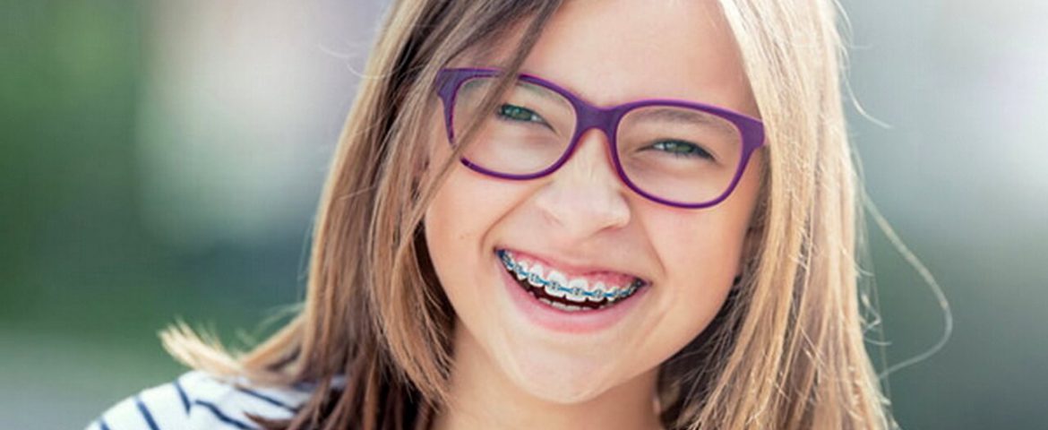 Aparatul dentar la copii: necesitate sau modă?